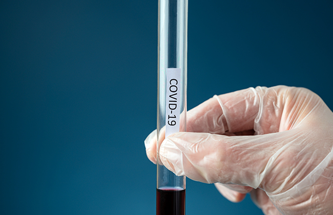 Hand of a doctor wearing protecting glove holding a glass test tube with blood sample and a Covid 19 sign on it. 